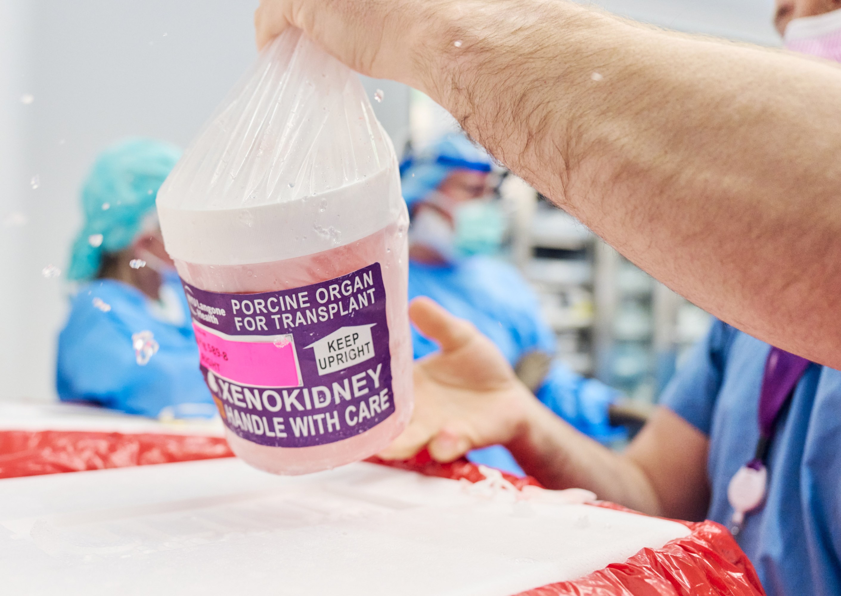 A container reading "Porcine organ for transplant. Keep Upright. Xenokidney. Handle with Care" being lifted from the cold transport box