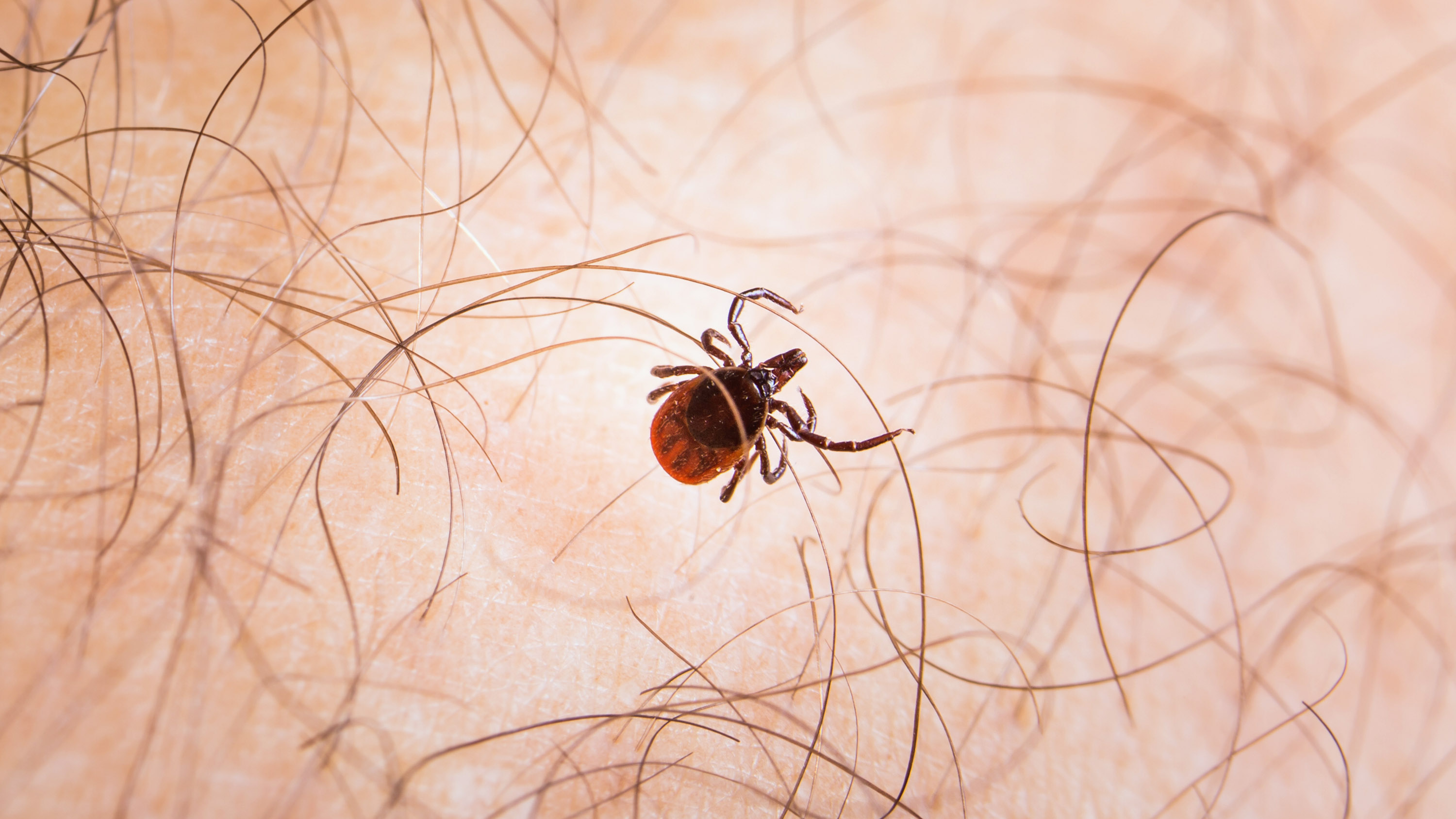 close-up on a tick on hairy skin